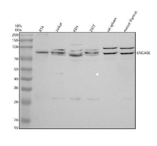 Anti-ELAC2 Antibody Picoband® Boster Bio