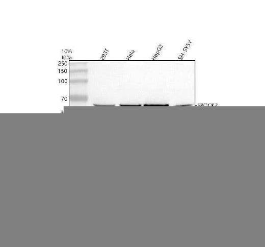 Anti-SPOCK2 Antibody Picoband® Boster Bio