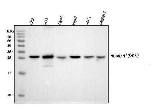 Anti-Histone H1.0/H1F0 Antibody Picoband® Boster Bio