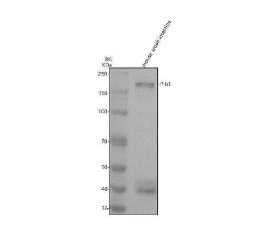 Anti-PLB1 Antibody Picoband® Boster Bio