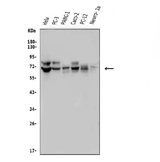 Anti-FRMD6/Willin Antibody Picoband® Boster Bio