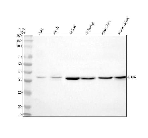 Anti-ADH6 Antibody Picoband® Boster Bio