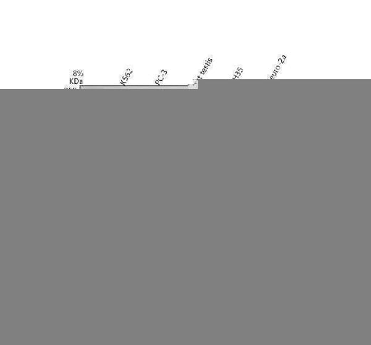 Anti-MTBP Antibody Picoband® Boster Bio