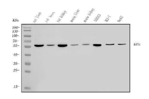 Anti-ALDH6A1 Antibody Picoband® Boster Bio