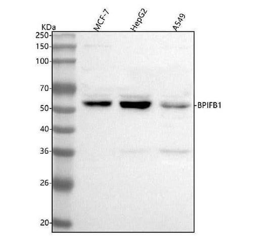 Anti-BPIFB1 Antibody Picoband® Boster Bio