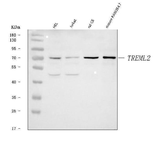 Anti-TREML2 Antibody Picoband® Boster Bio