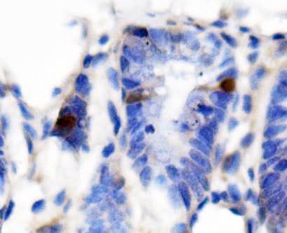 Anti-Secretin/Sct Antibody Boster Bio
