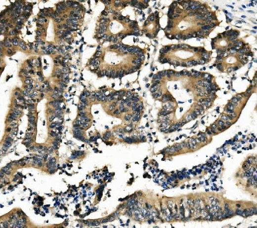 Anti-DNAJA2 Antibody Picoband® Boster Bio