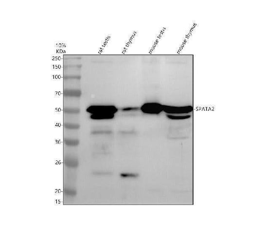Anti-SPATA2 Antibody Picoband® Boster Bio