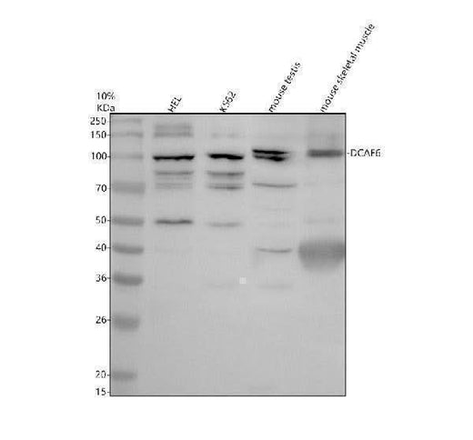 Anti-DCAF6 Antibody Picoband® Boster Bio