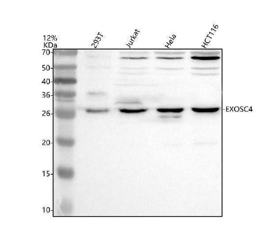 Anti-EXOSC4 Antibody Picoband® Boster Bio