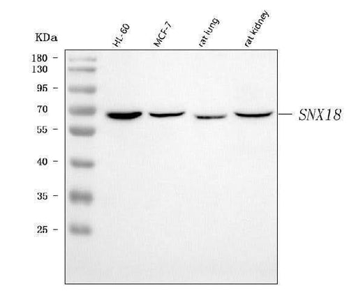 Anti-SNX18 Antibody Picoband® Boster Bio