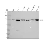 Anti-DHTKD1 Antibody Picoband® Boster Bio