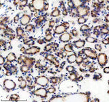 Anti-Teneurin 1/TENM1 Antibody Boster Bio