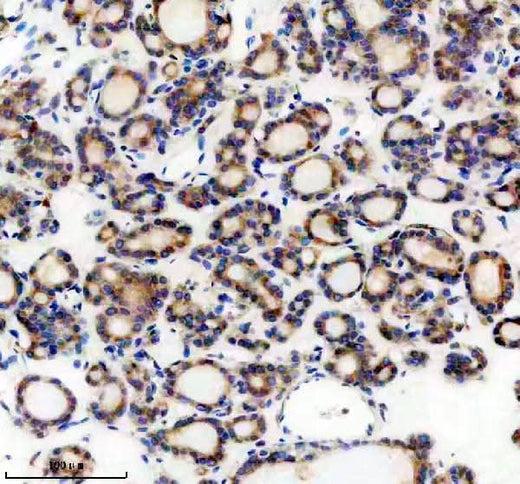 Anti-Teneurin 1/TENM1 Antibody Boster Bio