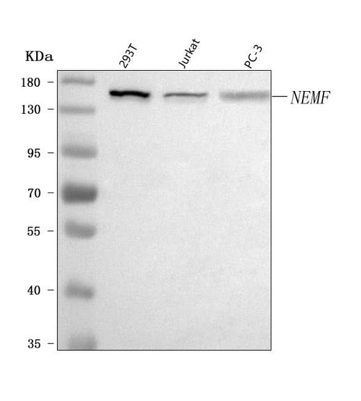 Anti-SDCCAG1/NEMF Antibody Picoband® Boster Bio