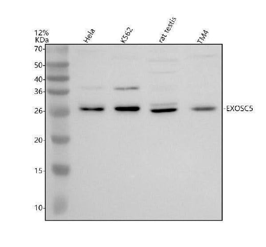 Anti-EXOSC5 Antibody Picoband® Boster Bio