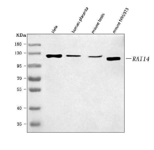 Anti-RAI14 Antibody Picoband® Boster Bio