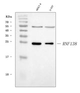 Anti-HSD-4/RNF138 Antibody Picoband® Boster Bio