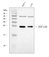 Anti-HSD-4/RNF138 Antibody Picoband® Boster Bio