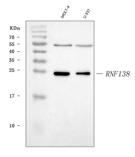 Anti-HSD-4/RNF138 Antibody Picoband® Boster Bio