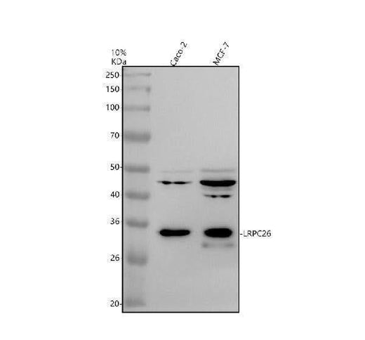 Anti-LRRC26 Antibody Picoband® Boster Bio