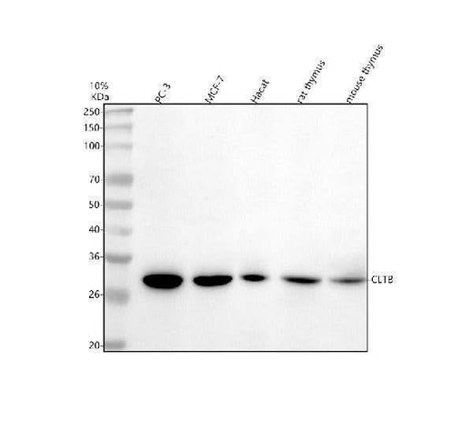 Anti-CLTB Antibody Picoband® Boster Bio