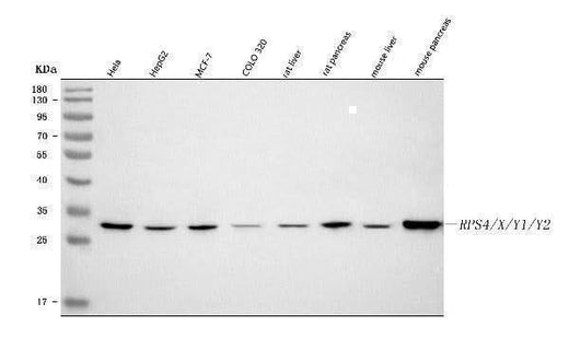 Anti-RPS4/X/Y1/Y2 Antibody Picoband® Boster Bio