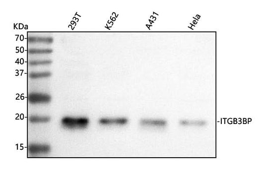 Anti-Centromere protein R/ITGB3BP Antibody Picoband® Boster Bio