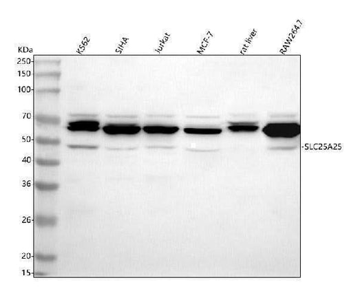 Anti-SLC25A25 Antibody Picoband® Boster Bio