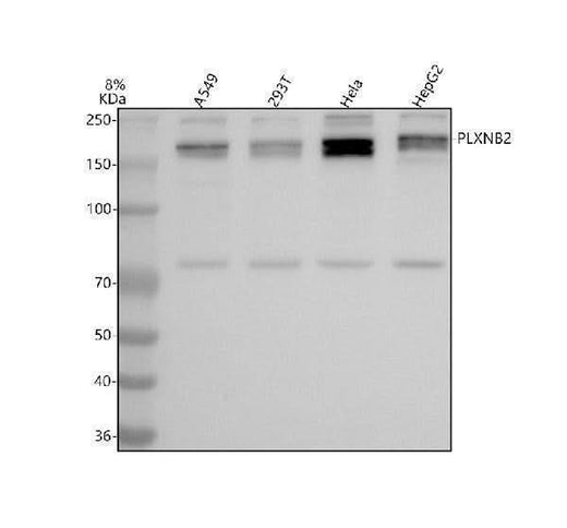 Anti-PLXNB2 Antibody Picoband® Boster Bio