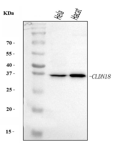 Anti-Claudin18/CLDN18 Antibody Picoband® Boster Bio