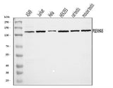 Anti-PEPP2/PLEKHA5 Antibody Picoband® Boster Bio