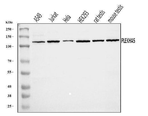 Anti-PEPP2/PLEKHA5 Antibody Picoband® Boster Bio
