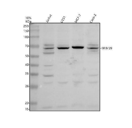 Anti-TRIM39 Antibody Picoband® Boster Bio