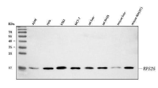 Anti-RPS25 Antibody Picoband® Boster Bio