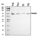 Anti-TOMM70 Antibody Picoband® Boster Bio