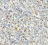 Anti-NKX2-3 Antibody Boster Bio