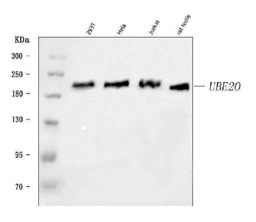 Anti-UBE2O Antibody Picoband® Boster Bio
