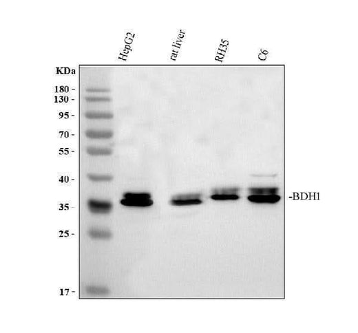 Anti-BDH1 Antibody Picoband® Boster Bio