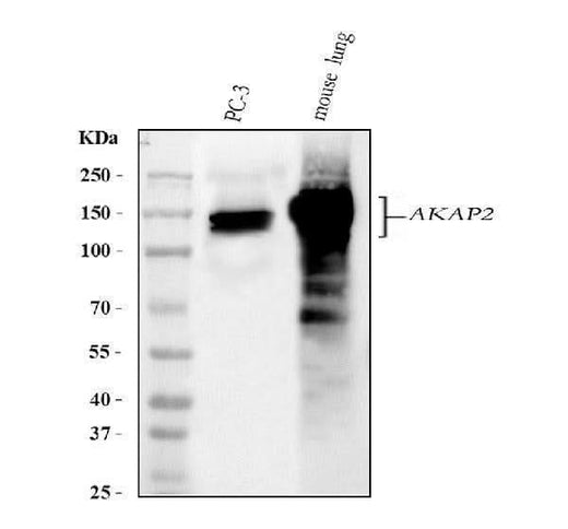 Anti-AKAP2 Antibody Picoband® Boster Bio