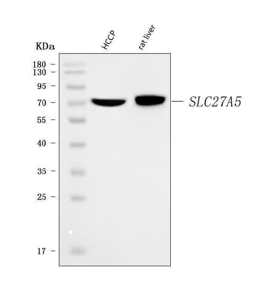 Anti-BAL/SLC27A5 Antibody Picoband® Boster Bio