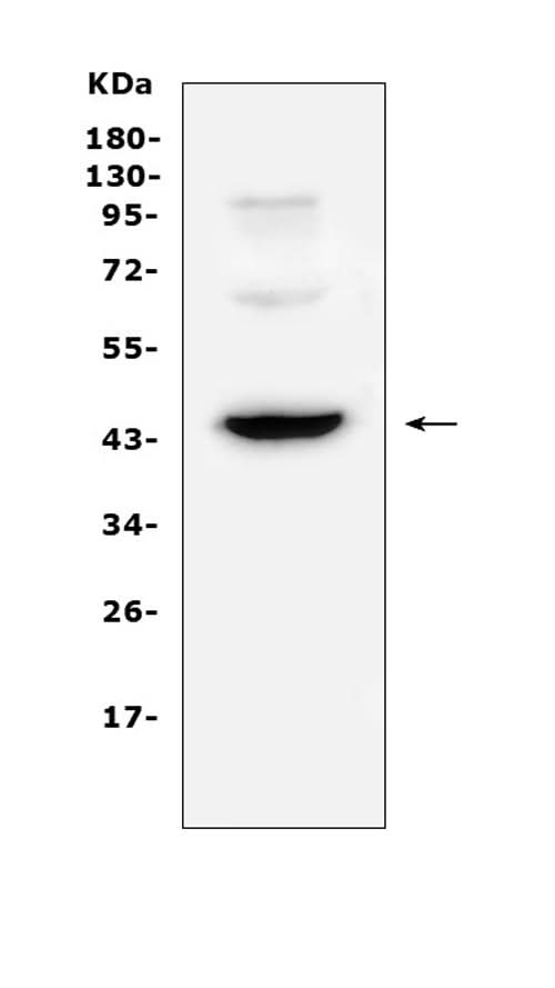 Anti-CD72 Antibody Picoband® Boster Bio
