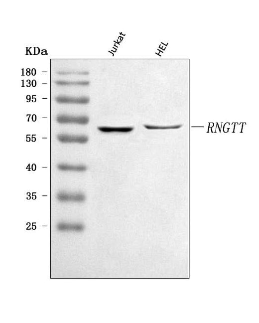 Anti-RNGTT Antibody Picoband® Boster Bio