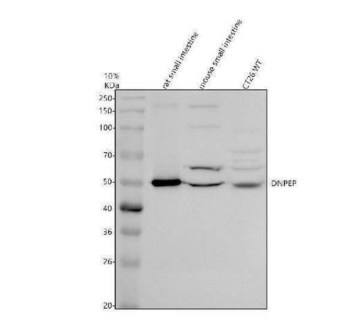 Anti-DNPEP Antibody Picoband® Boster Bio