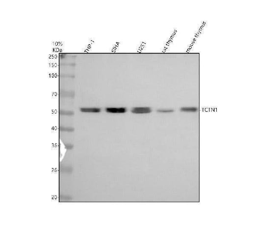 Anti-TCTN1 Antibody Picoband® Boster Bio