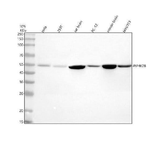 Anti-PIP4K2B Antibody Picoband® Boster Bio