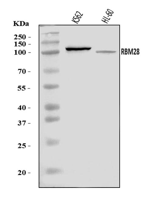 Anti-RBM28 Antibody Picoband® Boster Bio