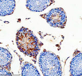 Anti-ODAM Antibody Boster Bio