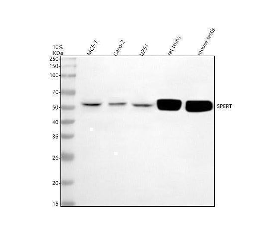 Anti-CBY2 Antibody Picoband® Boster Bio